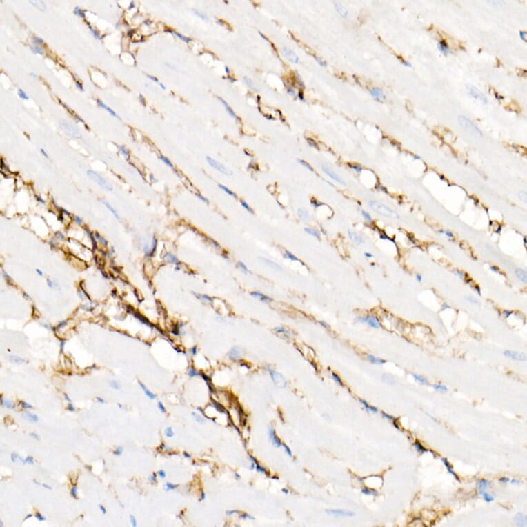 Immunohistochemistry - Anti-Annexin A2 Antibody (A13514) - Antibodies.com
