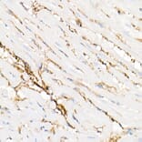 Immunohistochemistry - Anti-Annexin A2 Antibody (A13514) - Antibodies.com