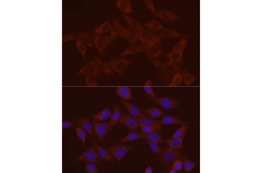 Immunofluorescence - Anti-Annexin A2 Antibody (A13514) - Antibodies.com