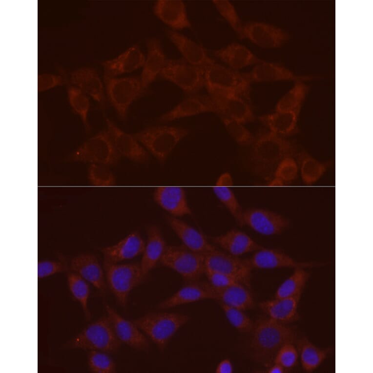 Immunofluorescence - Anti-Annexin A2 Antibody (A13514) - Antibodies.com