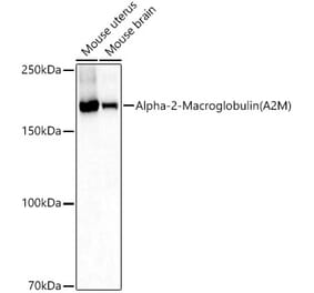 Western Blot - Anti-alpha 2 Macroglobulin Antibody (A13515) - Antibodies.com