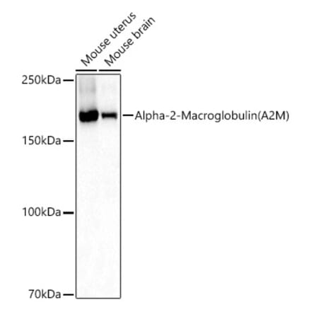 Western Blot - Anti-alpha 2 Macroglobulin Antibody (A13515) - Antibodies.com