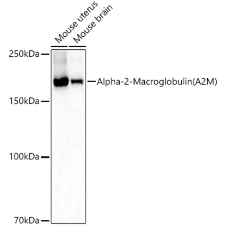 Western Blot - Anti-alpha 2 Macroglobulin Antibody (A13515) - Antibodies.com