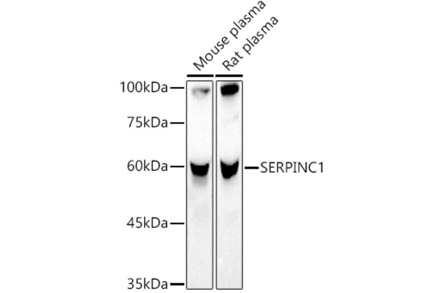 Western Blot - Anti-Antithrombin III/ATIII Antibody (A13516) - Antibodies.com