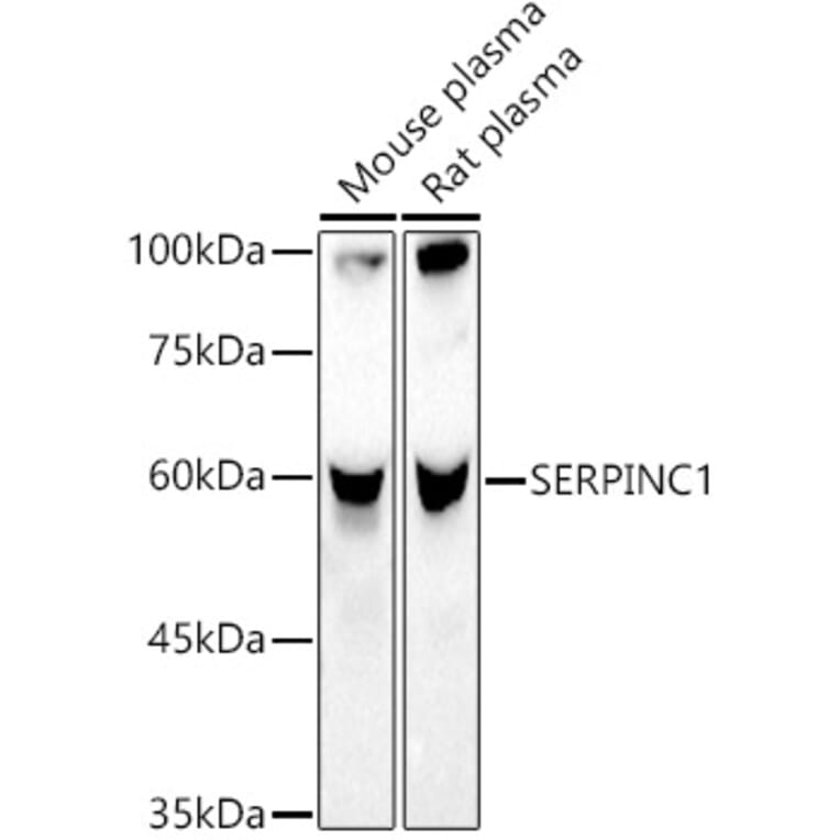 Western Blot - Anti-Antithrombin III/ATIII Antibody (A13516) - Antibodies.com