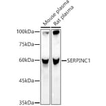 Western Blot - Anti-Antithrombin III/ATIII Antibody (A13516) - Antibodies.com