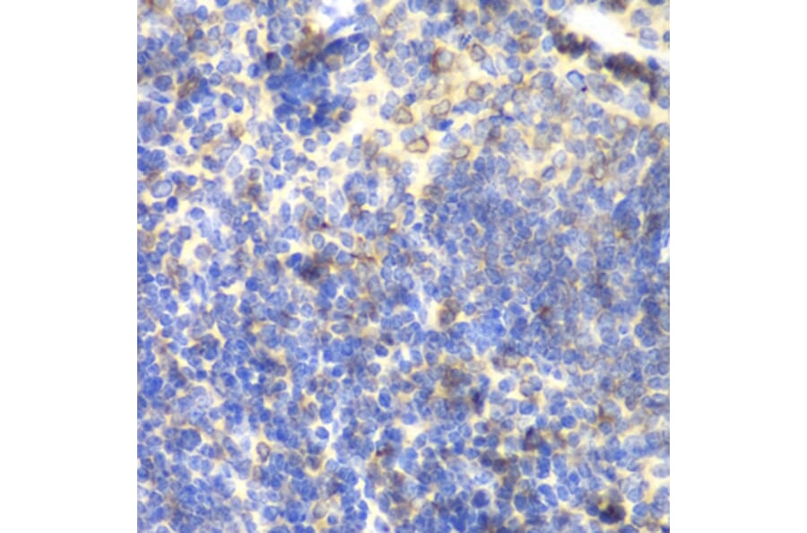 Immunohistochemistry - Anti-BTK Antibody (A13517) - Antibodies.com