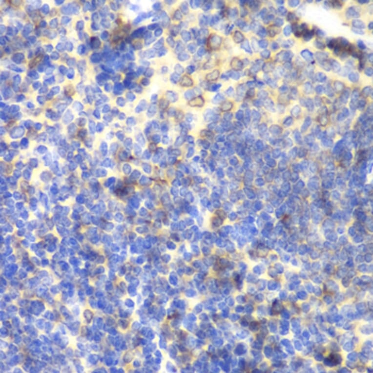 Immunohistochemistry - Anti-BTK Antibody (A13517) - Antibodies.com