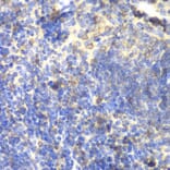 Immunohistochemistry - Anti-BTK Antibody (A13517) - Antibodies.com