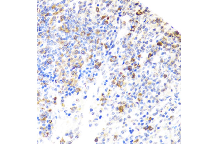 Immunohistochemistry - Anti-BTK Antibody (A13517) - Antibodies.com