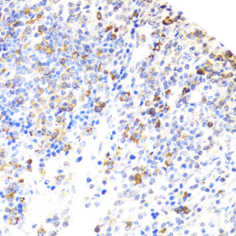 Immunohistochemistry - Anti-BTK Antibody (A13517) - Antibodies.com