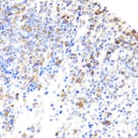 Immunohistochemistry - Anti-BTK Antibody (A13517) - Antibodies.com