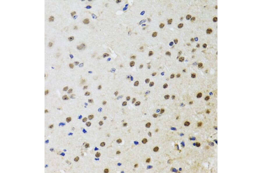 Immunohistochemistry - Anti-BTK Antibody (A13517) - Antibodies.com