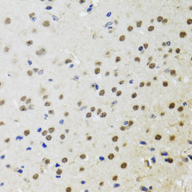Immunohistochemistry - Anti-BTK Antibody (A13517) - Antibodies.com