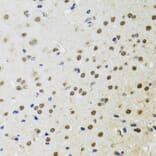 Immunohistochemistry - Anti-BTK Antibody (A13517) - Antibodies.com