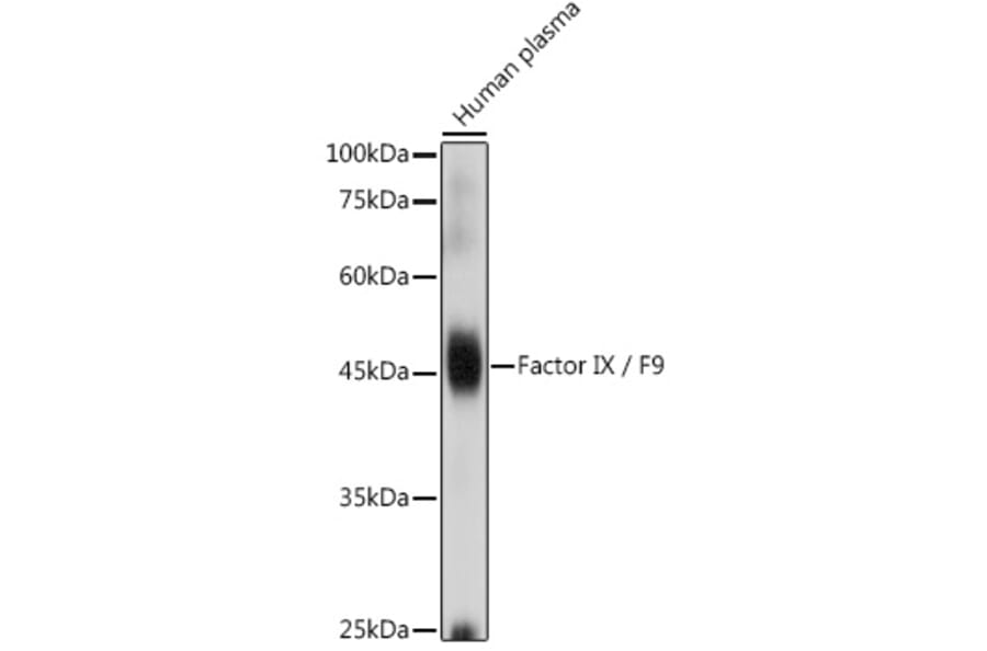 Western Blot - Anti-Factor IX/PTC Antibody (A13519) - Antibodies.com