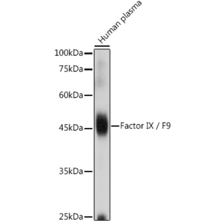 Western Blot - Anti-Factor IX/PTC Antibody (A13519) - Antibodies.com