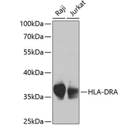 Western Blot - Anti-HLA-DR Antibody (A13520) - Antibodies.com