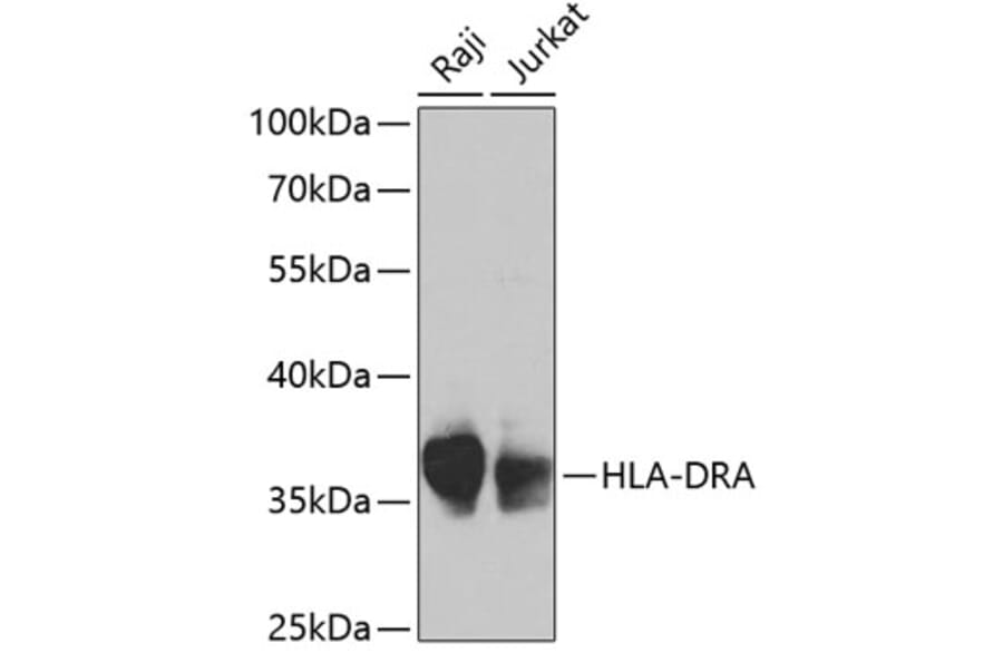 Western Blot - Anti-HLA-DR Antibody (A13520) - Antibodies.com