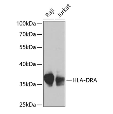 Western Blot - Anti-HLA-DR Antibody (A13520) - Antibodies.com