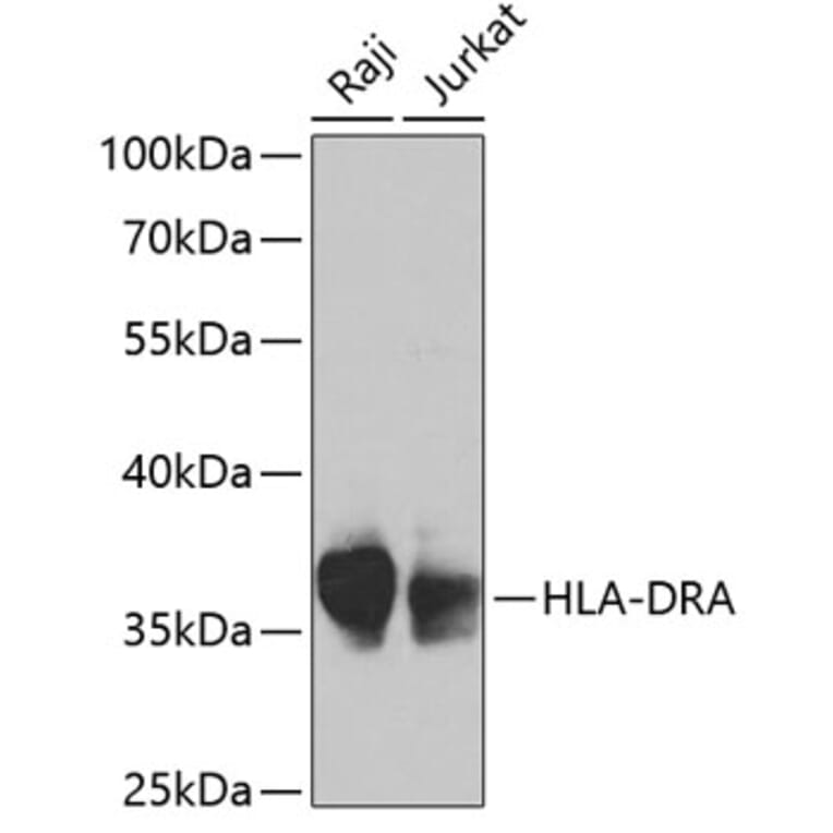 Western Blot - Anti-HLA-DR Antibody (A13520) - Antibodies.com