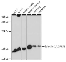 Western Blot - Anti-Galectin 1 Antibody (A13521) - Antibodies.com