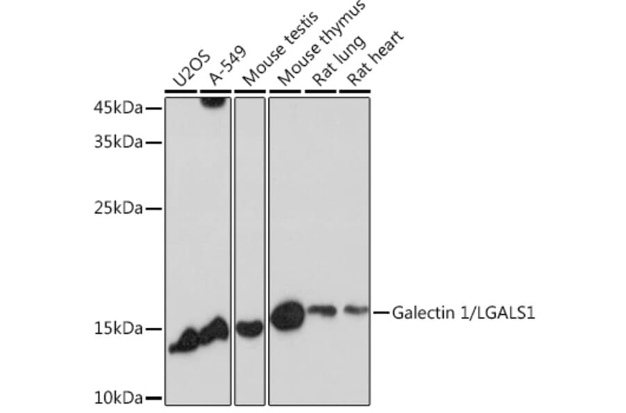 Western Blot - Anti-Galectin 1 Antibody (A13521) - Antibodies.com