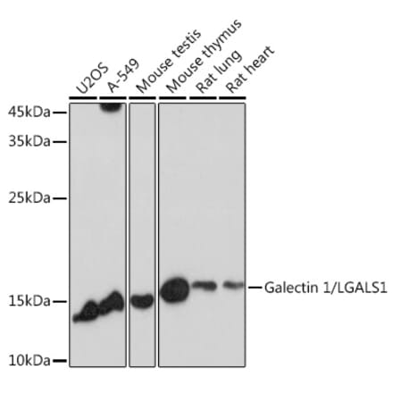 Western Blot - Anti-Galectin 1 Antibody (A13521) - Antibodies.com