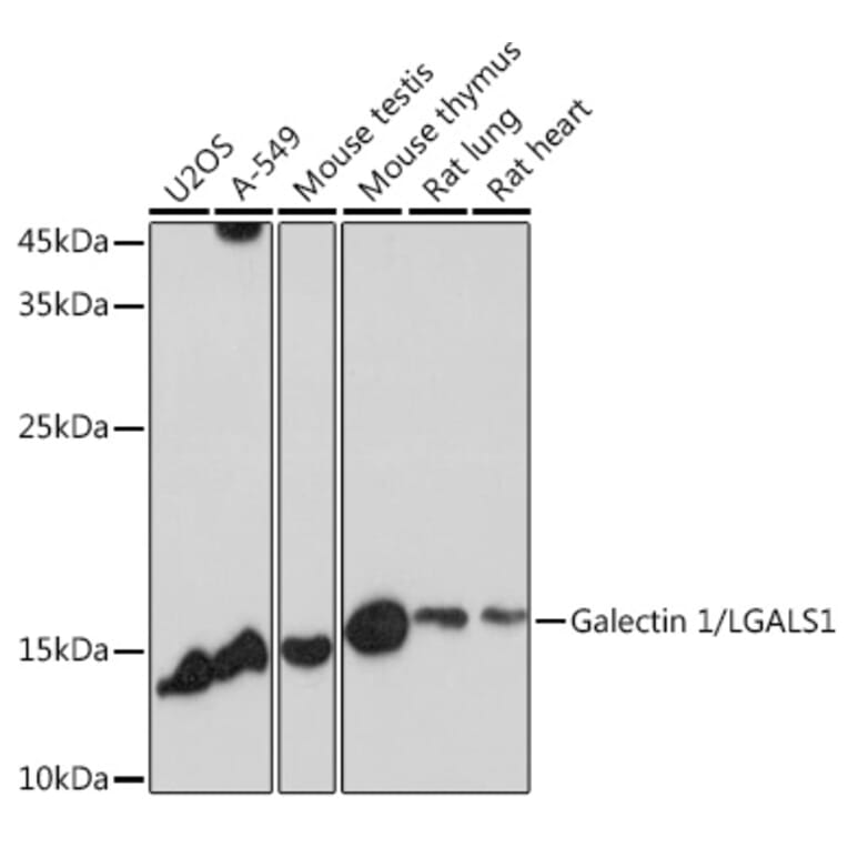 Western Blot - Anti-Galectin 1 Antibody (A13521) - Antibodies.com