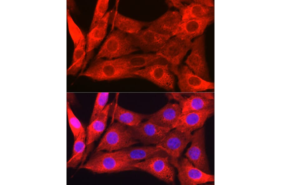 Immunofluorescence - Anti-Galectin 1 Antibody (A13521) - Antibodies.com