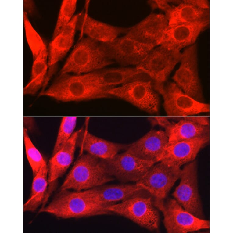 Immunofluorescence - Anti-Galectin 1 Antibody (A13521) - Antibodies.com