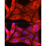 Immunofluorescence - Anti-Galectin 1 Antibody (A13521) - Antibodies.com