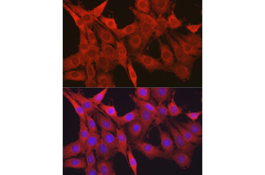 Immunofluorescence - Anti-Galectin 1 Antibody (A13521) - Antibodies.com