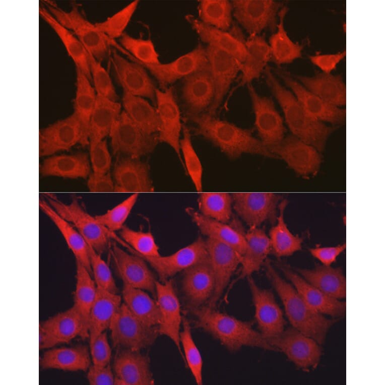 Immunofluorescence - Anti-Galectin 1 Antibody (A13521) - Antibodies.com