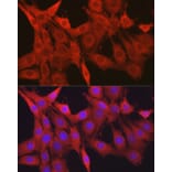 Immunofluorescence - Anti-Galectin 1 Antibody (A13521) - Antibodies.com