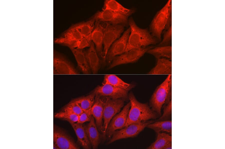 Immunofluorescence - Anti-Galectin 1 Antibody (A13521) - Antibodies.com
