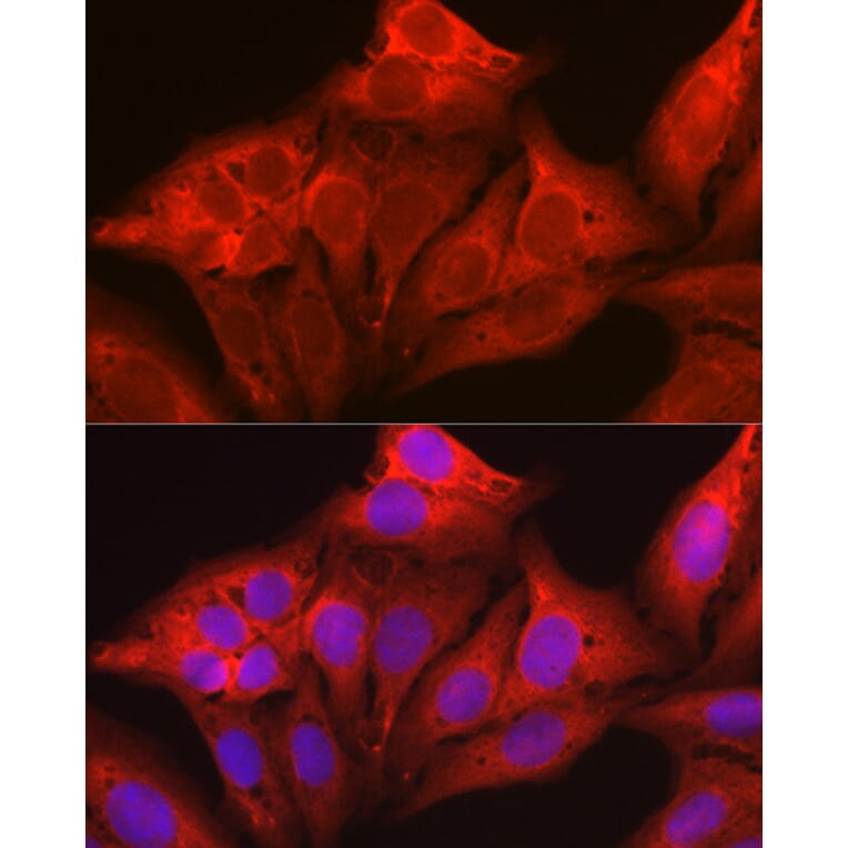 Immunofluorescence - Anti-Galectin 1 Antibody (A13521) - Antibodies.com