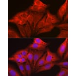 Immunofluorescence - Anti-Galectin 1 Antibody (A13521) - Antibodies.com