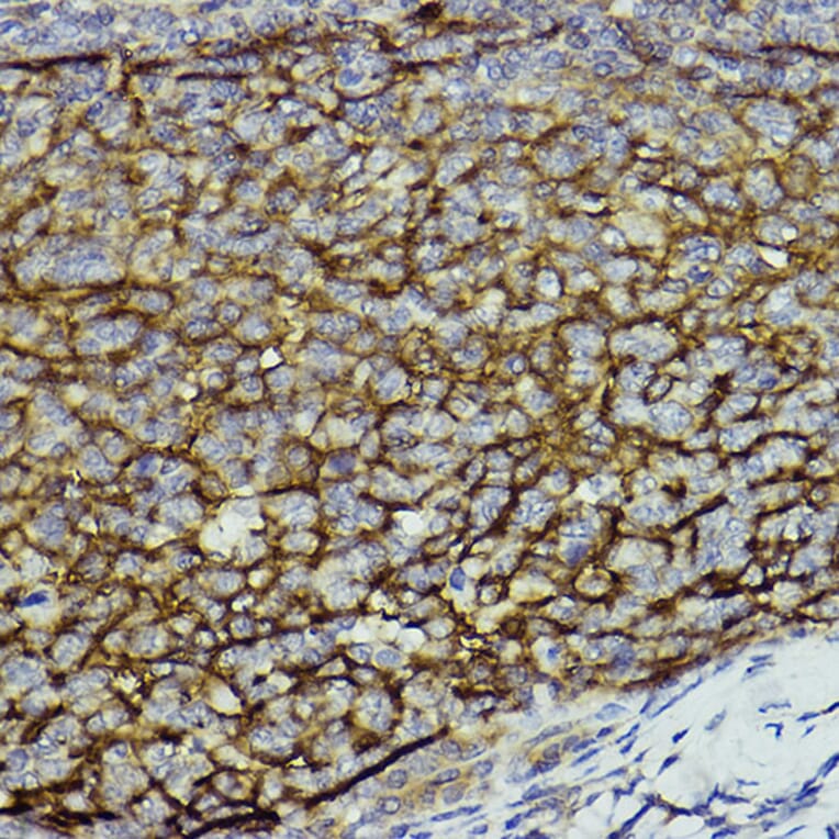Immunohistochemistry - Anti-CD11b Antibody (A13522) - Antibodies.com