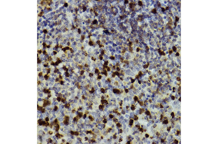 Immunohistochemistry - Anti-CD11b Antibody (A13522) - Antibodies.com
