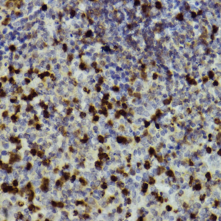 Immunohistochemistry - Anti-CD11b Antibody (A13522) - Antibodies.com