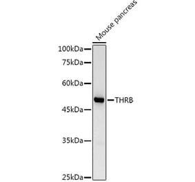 Western Blot - Anti-Thyroid Hormone Receptor beta Antibody (A13523) - Antibodies.com