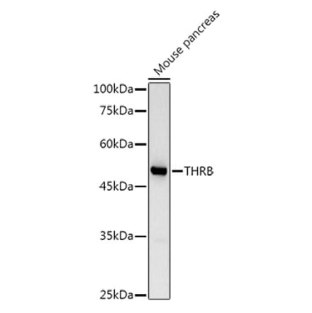 Western Blot - Anti-Thyroid Hormone Receptor beta Antibody (A13523) - Antibodies.com