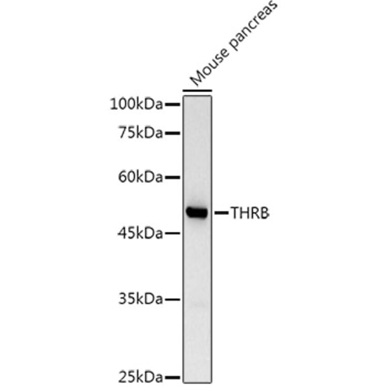 Western Blot - Anti-Thyroid Hormone Receptor beta Antibody (A13523) - Antibodies.com