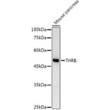 Western Blot - Anti-Thyroid Hormone Receptor beta Antibody (A13523) - Antibodies.com