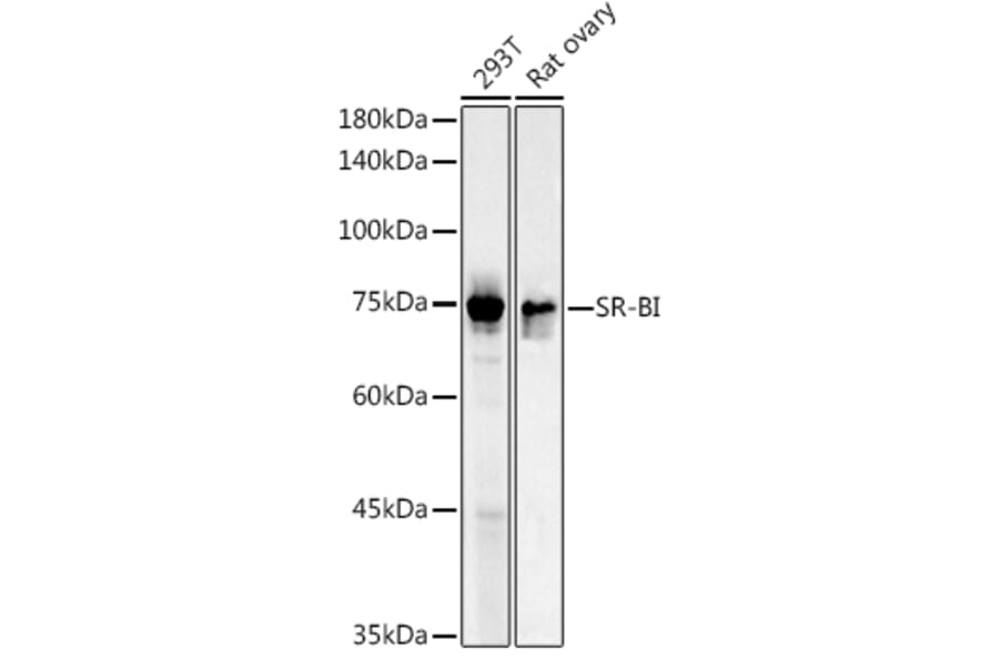 Western Blot - Anti-Scavenging Receptor SR-BI Antibody (A13525) - Antibodies.com