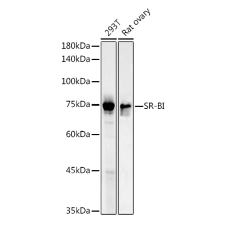 Western Blot - Anti-Scavenging Receptor SR-BI Antibody (A13525) - Antibodies.com