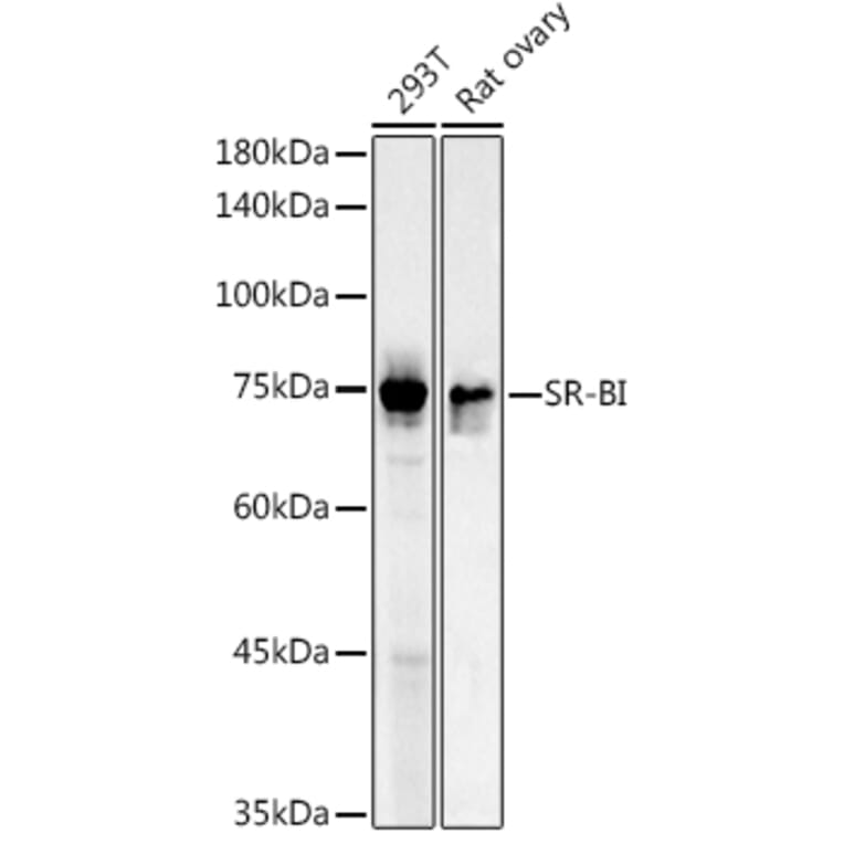 Western Blot - Anti-Scavenging Receptor SR-BI Antibody (A13525) - Antibodies.com
