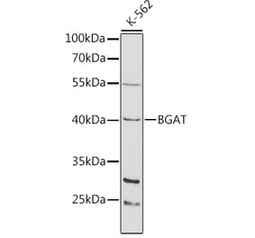 Western Blot - Anti-ABO Antibody (A13526) - Antibodies.com