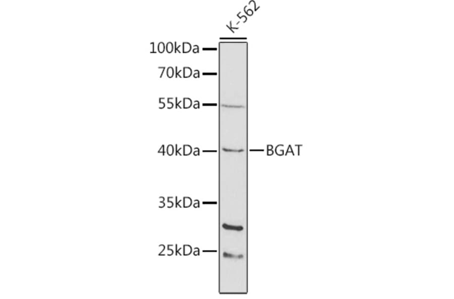Western Blot - Anti-ABO Antibody (A13526) - Antibodies.com